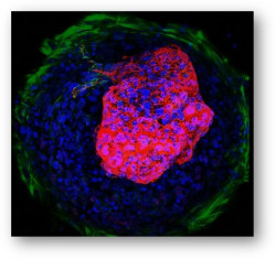 Corazón en miniatura, por Dr. José Manuel Revuelta