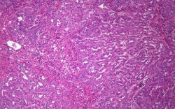 Desarrollan c&eacute;lulas hep&aacute;ticas funcionales a partir de tejido cut&aacute;neo para reparar el ciclo de la urea