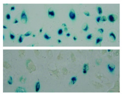 Descubren que un compuesto derivado de la an&eacute;mona del mar Caribe podr&iacute;a mejorar el tratamiento contra el c&aacute;ncer