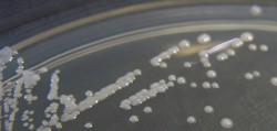 Descubren un nuevo y prometedor antimic&oacute;tico procedente de una bacteria marina