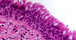 El epitelio del intestino se contraer r&aacute;pidamente cuando reconoce un ataque bacteriano para protegerse de la infecci&oacute;n