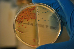 Las bacterias resistentes a los antibi&oacute;ticos ya provocan m&aacute;s muertes que el sida y la malaria, seg&uacute;n un estudio