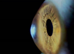 Los cient&iacute;ficos dan un paso importante hacia el uso de trasplantes de c&eacute;lulas de retina para tratar la ceguera
