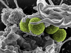 Los cient&iacute;ficos descubren el secreto de la virulencia de las superbacterias en las infecciones diab&eacute;ticas