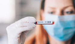Sanidad notifica 6.469 nuevos casos de coronavirus, 149 muertes y la incidencia se reduce a 130