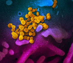 Un equipo del CSIC produce anticuerpos neutralizantes eficaces contra la COVID-19
