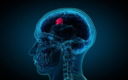 Un proceso metab&oacute;lico en las c&eacute;lulas cancerosas podr&iacute;a conducir a un posible tratamiento para el glioblastoma